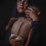 Gazze'deki başka bir çocuk açlıktan öldü