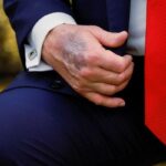 Bu ziyaret sırasında dikkat çekti! Amerika Birleşik Devletleri Başkanı Trump'ın çürüğü gündemdi: Bildirge Beyaz Saray'dan geldi